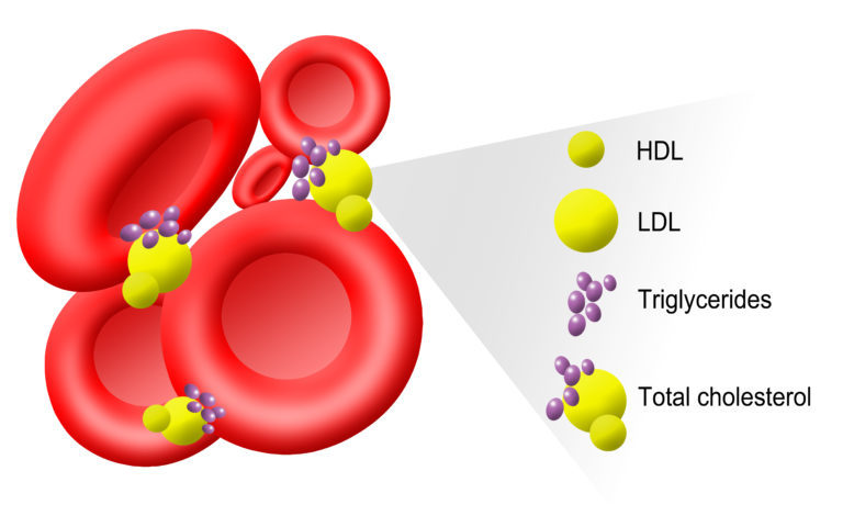 cholesterol