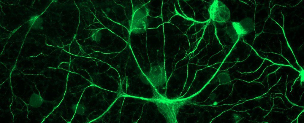 Click to enlarge neurons