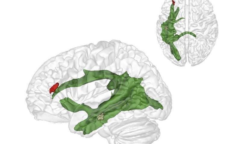 Click to enlarge brain structures