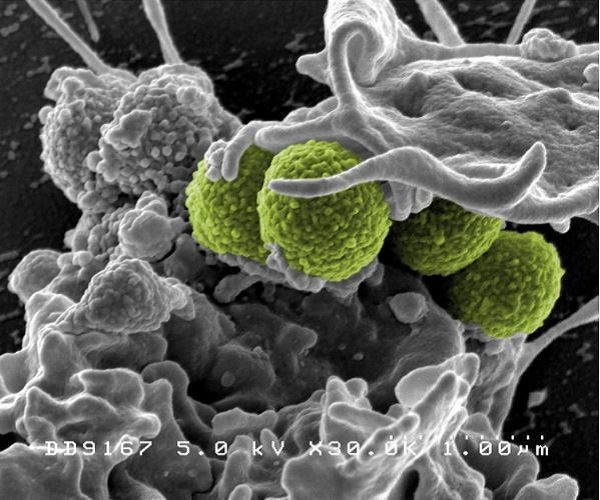 Click to enlarge MRSA