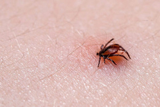 Tick on human skin