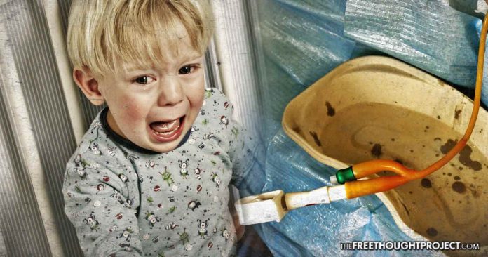 Catheterize 3yo Boy