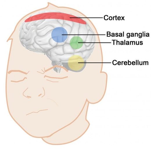 Tourette Model