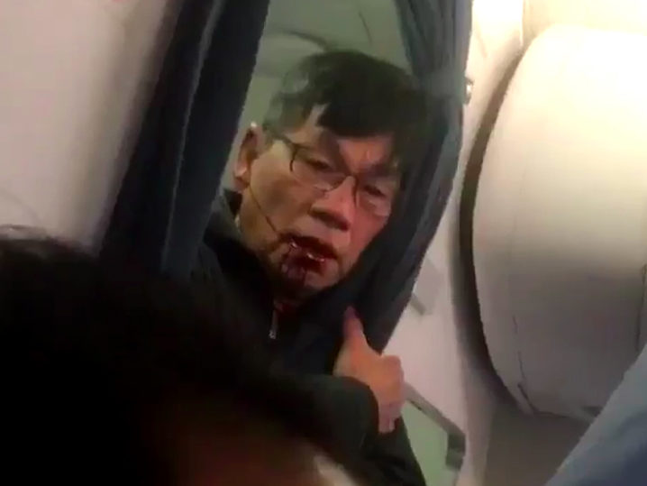 David Dao, United Scandal