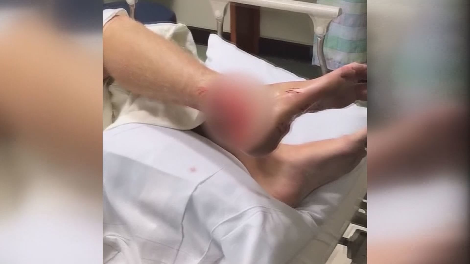Click to enlarge shark bite