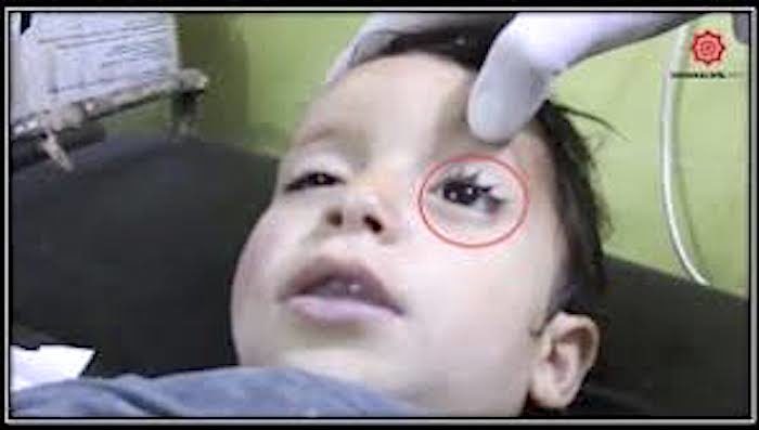 Click to enlarge boy eye circled