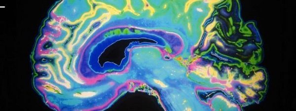 Click to enlarge brain scan