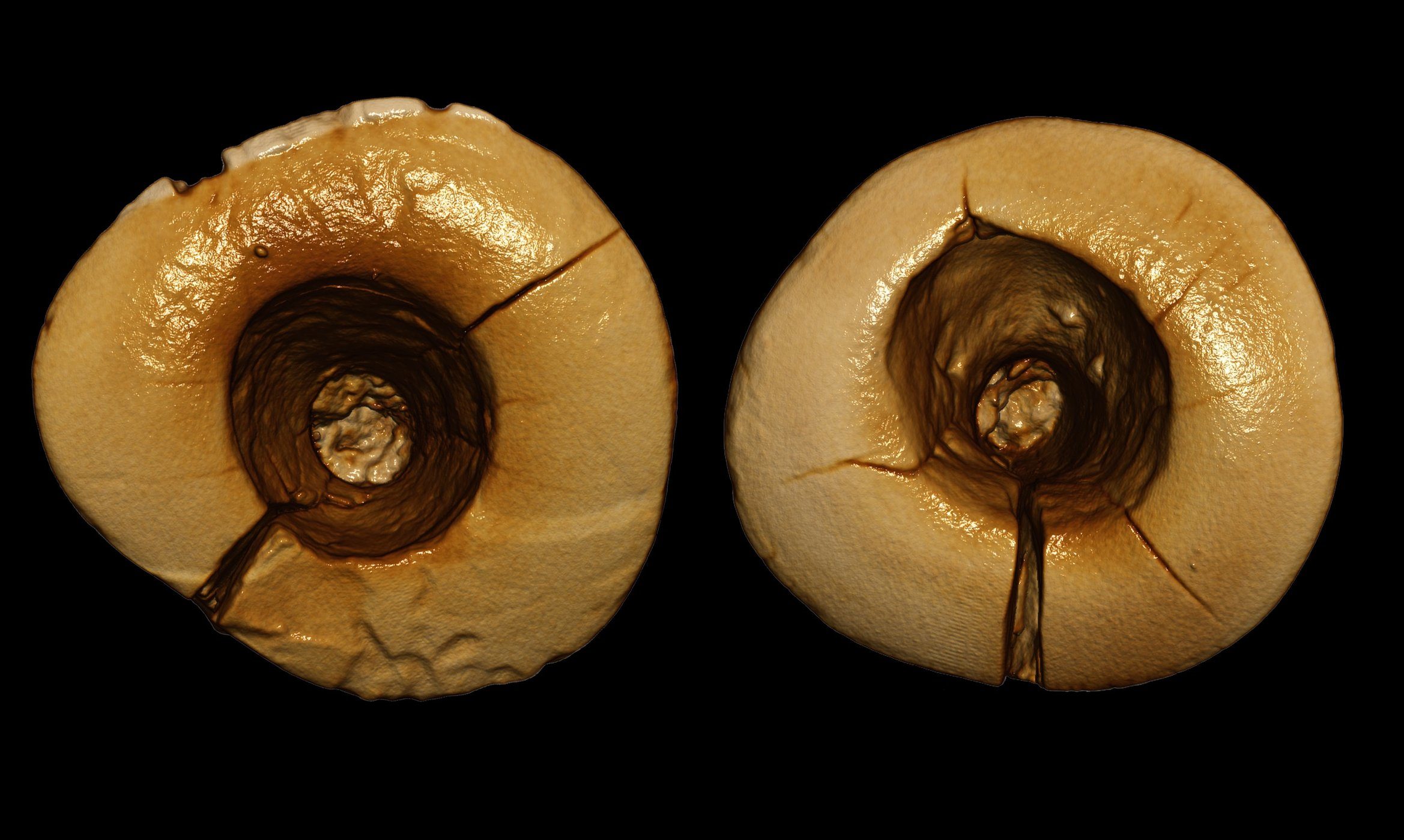 Ancient Dental Fillings
