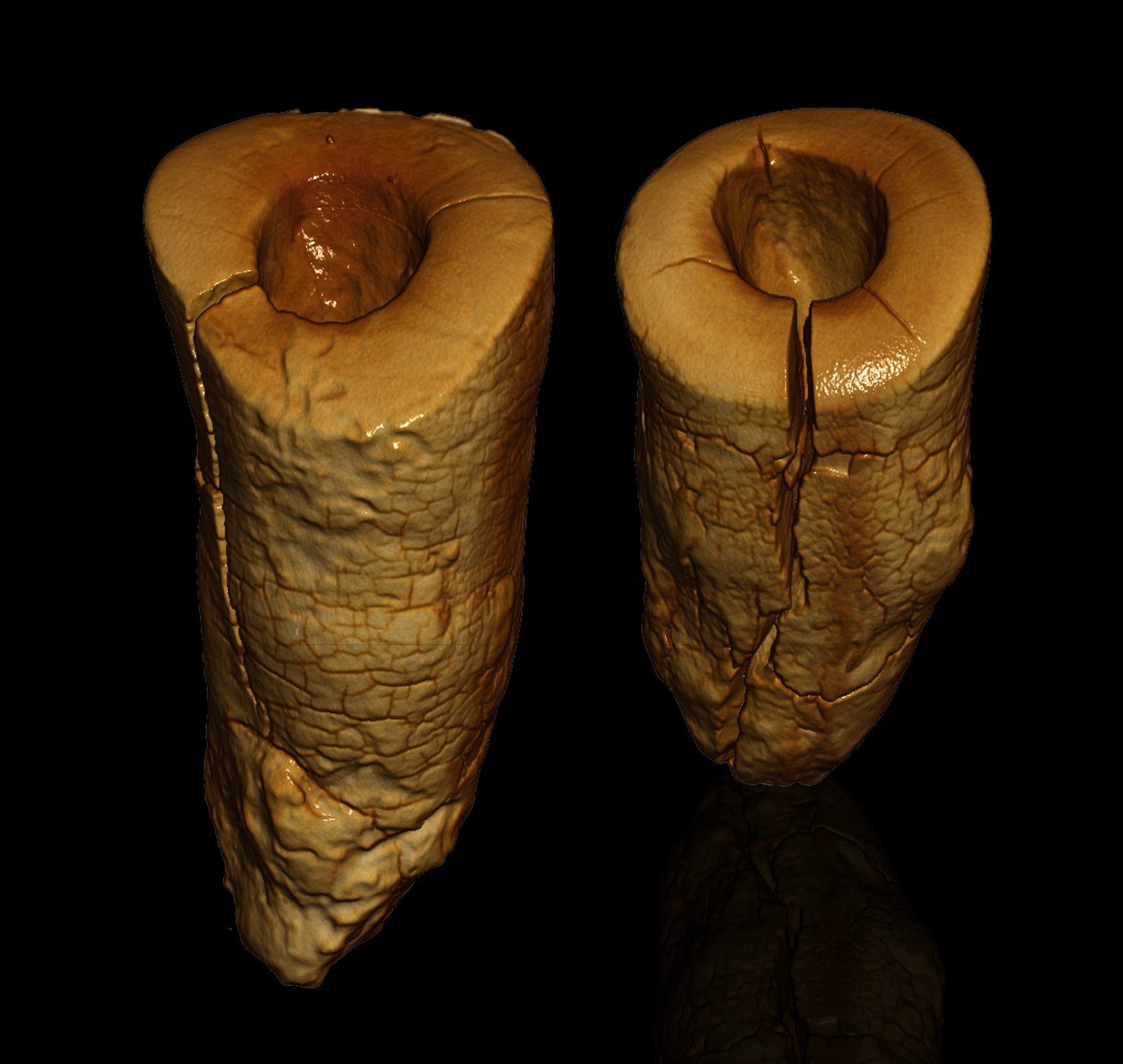 Click to enlarge Ancient Tooth Holes