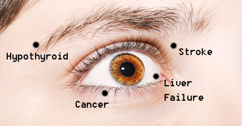 eye and health