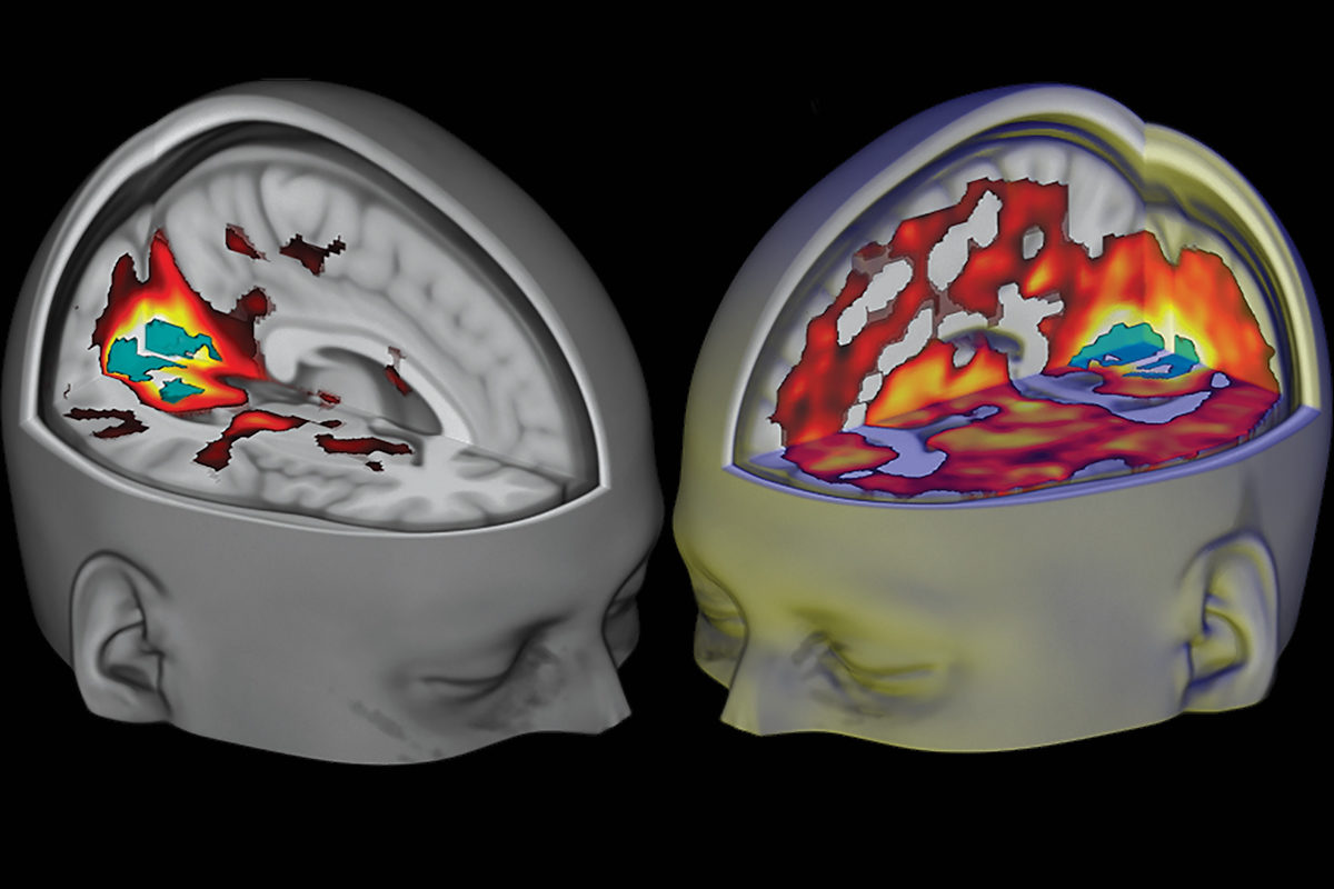 Click to enlarge brain activity