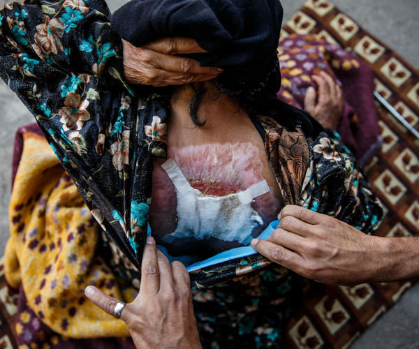 Click to enlarge Zorha Hasan Ali mosul airstrike