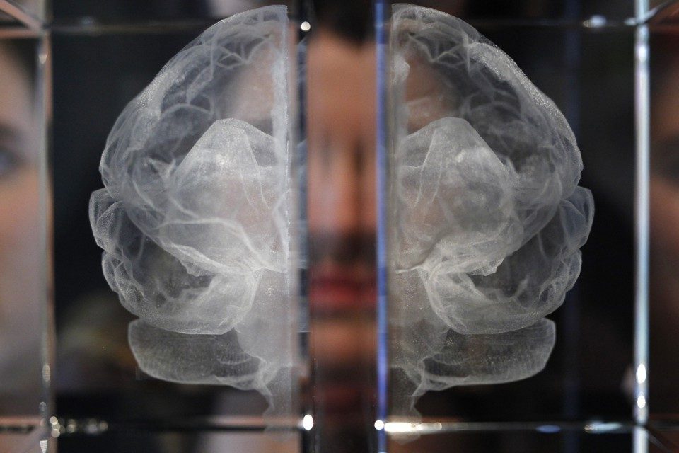 Click to enlarge poverty changes brain