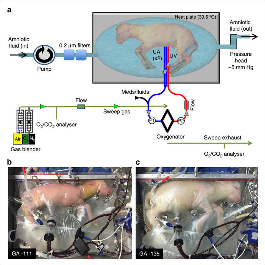 Artificial Womb