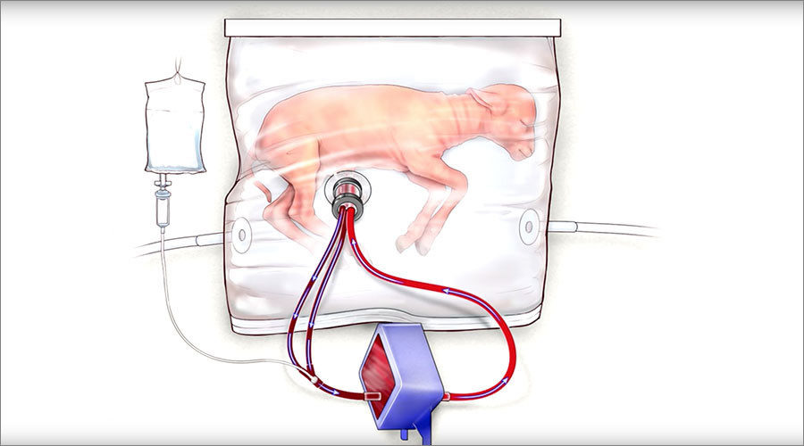 Artificial Womb