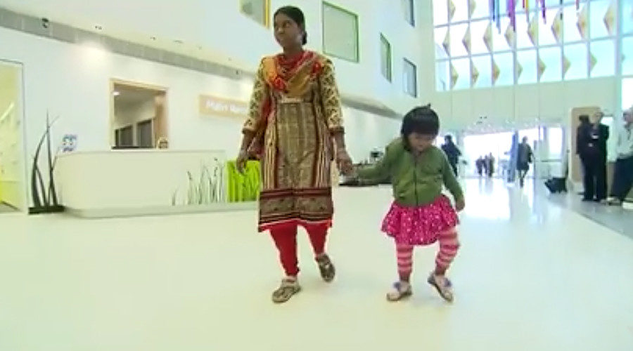 toddler and mother parasitic twin