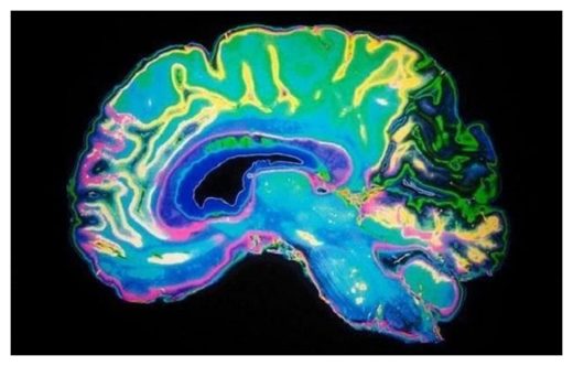 Striatum 