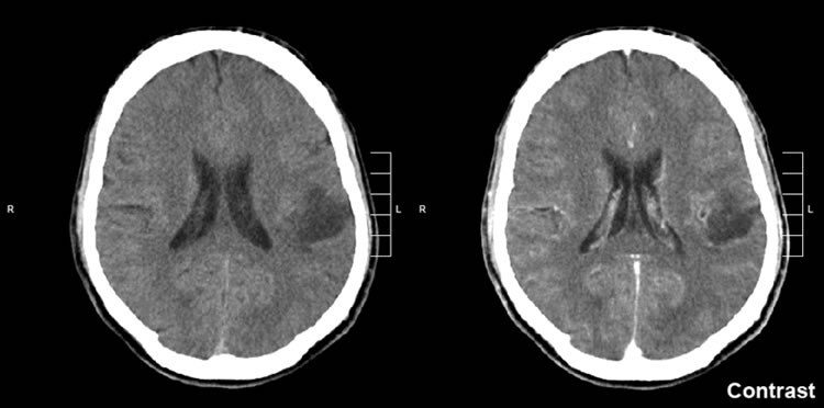 Click to enlarge Brain imaging