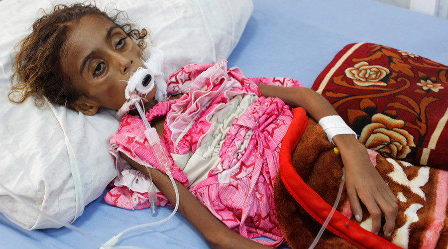 Malnourished girl Jamila Ali Abdu
