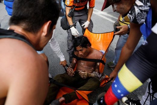 Violent Venezuela opposition protests