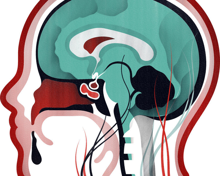 Click to enlarge guinea pig brain