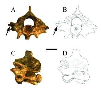 Vertebrae