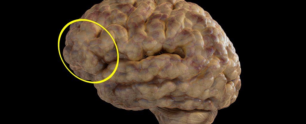 prefrontal cortex