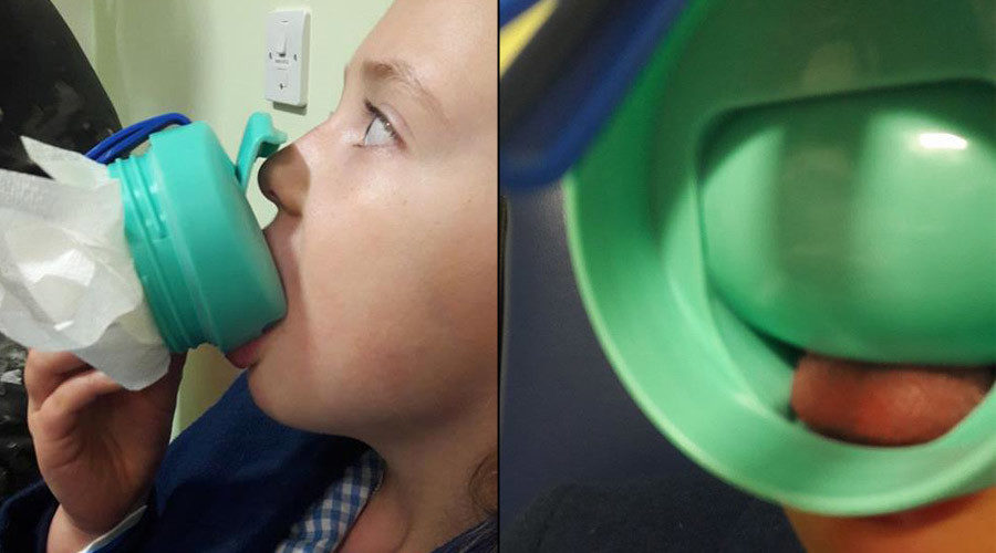 Click to enlarge 7yo girl's tongue removed from Disney mug