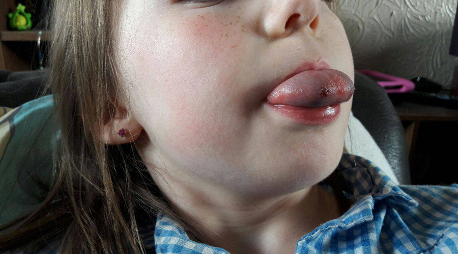 Click to enlarge Girl's tongue from Disney cup