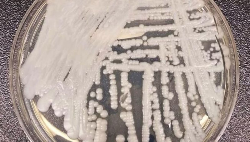 Candida auris