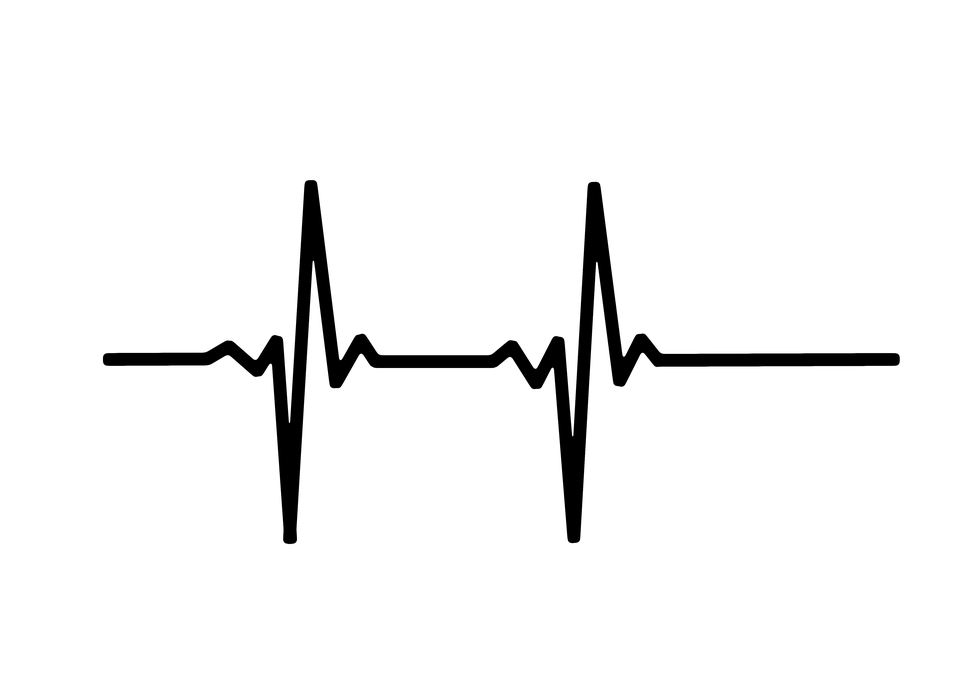 ekg reading