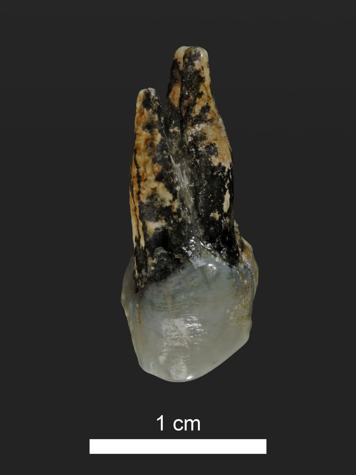 Click to enlarge Upper PreMolar