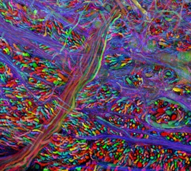 Virus engineered brain scan of auditory region