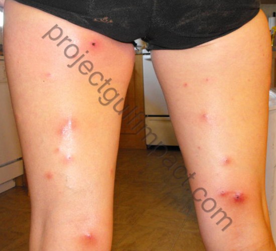 Click to enlarge Skin Lesions
