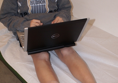 Click to enlarge laptop skin damage