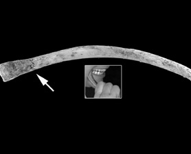 rib bone