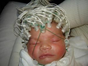Click to enlarge Baby with electrodes