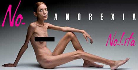 Click to enlarge anorexia
