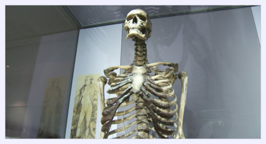 Click to enlarge Charles Byrne Skeleton