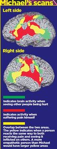 Michael Mosley Brain Scans