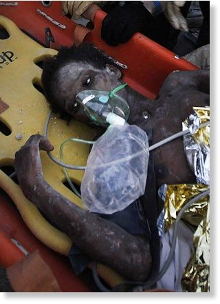 Click to enlarge Haiti Earthquake victim