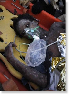 Haiti Earthquake victim