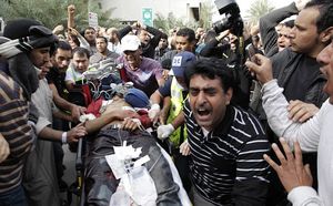 A protestor, brutally wounded by police