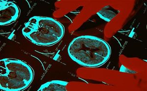 brain scan