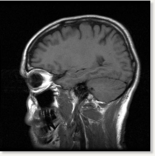 Click to enlarge Brainscan