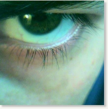 eye