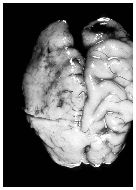 Click to enlarge Mushy Brain
