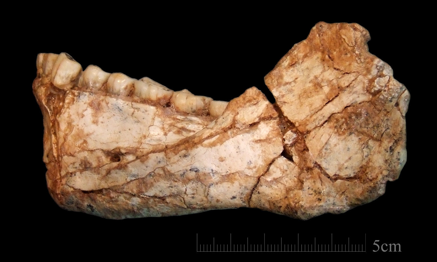 Adult mandible