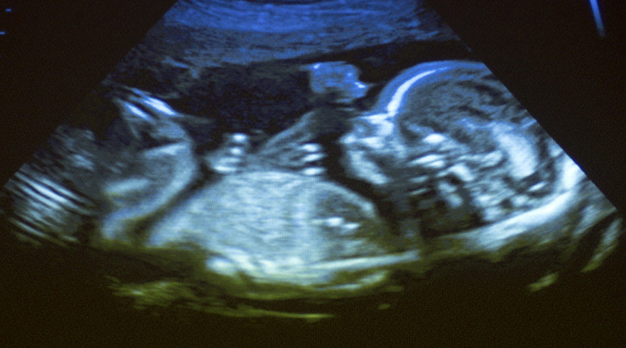 Click to enlarge human fetus