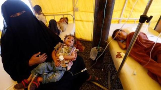 Yemini child infected with cholera